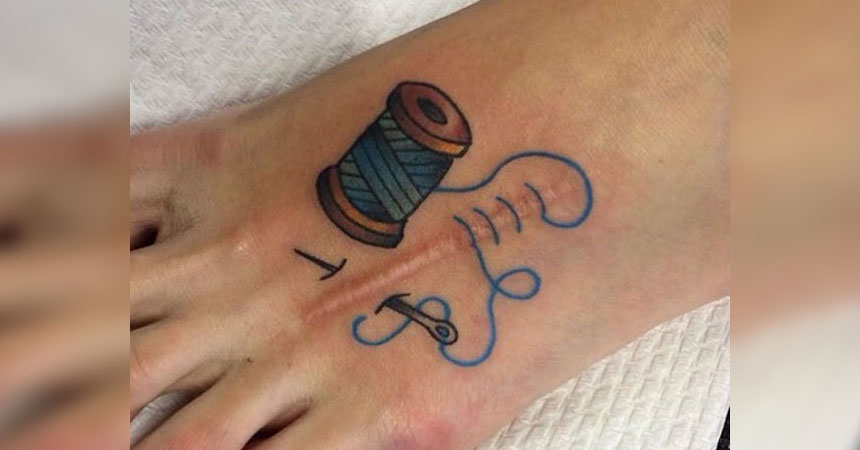 10 tatuajes que convirtieron cicatrices en verdaderas obras de arte ...